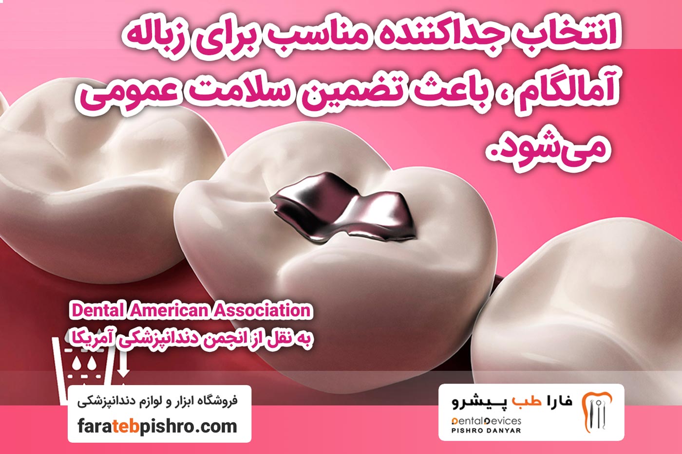 انتخاب جداکننده مناسب برای زباله آمالگام باعث تضمین سلامت عمومی می‌شود.