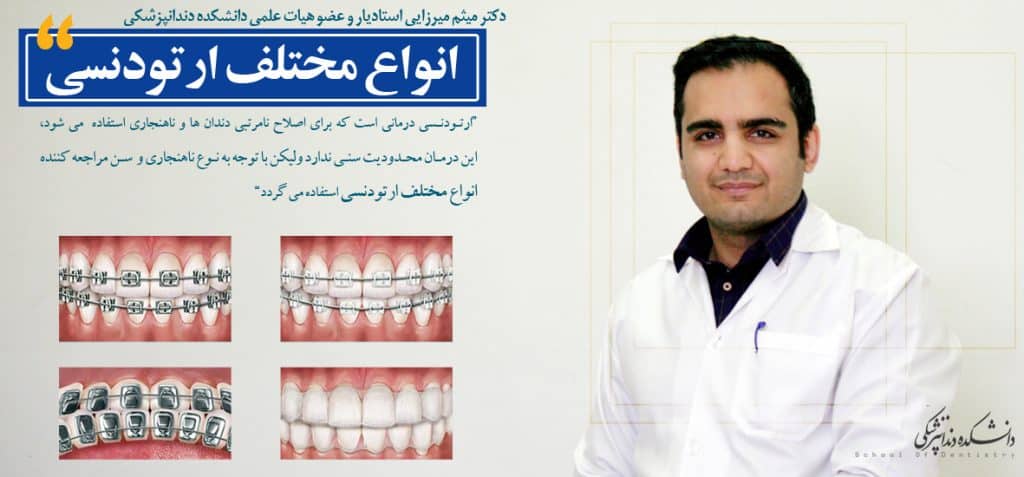 انواع مختلف ارتودنسی