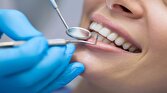 اجرای طرح هر مطب دندانپزشکی پایگاه ارتقای سلامت دهان؛ به زودی