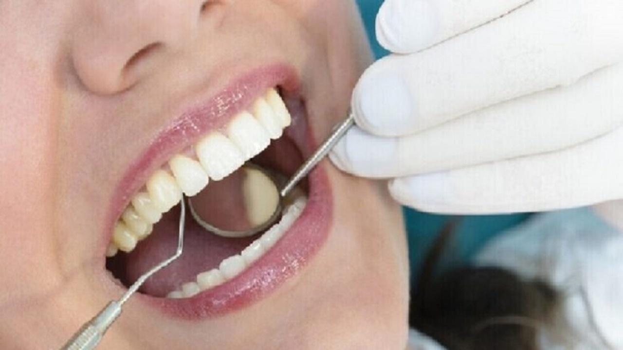 کشف یک شیرینی جدید برای تقویت و سفیدی دندان‌ها