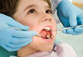 به ازای هر ۲۵۰۰ نفر یک دندان پزشک در کشور داریم/ دو عامل بروز پوسیدگی و مشکلات دهان و دندان